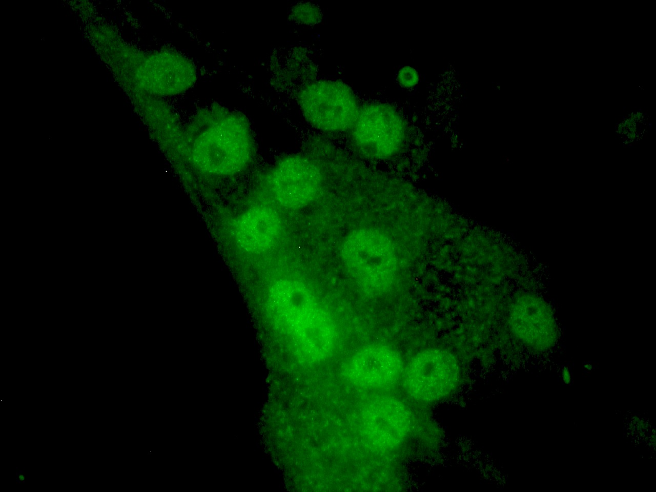 Figure 2. MyoD1 immunostaining of nuclei in MyoD1 transfected cells induced to undergo muscle cell differentiation.